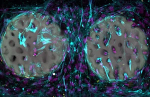 Implantes de hidrogel impressos a laser podem transformar o reparo ósseo