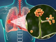 Esta proteína comum do sangue pode impedir um fungo negro mortal