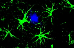 Cientistas transformam células cerebrais em limpadores de placa de Alzheimer
