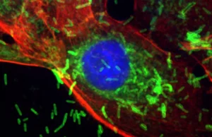 Bactérias que causam doenças gengivais estão ligadas ao crescimento e disseminação do câncer de mama