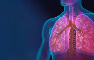 Cobiça ou gripe grave podem aumentar o risco de câncer de pulmão anos depois