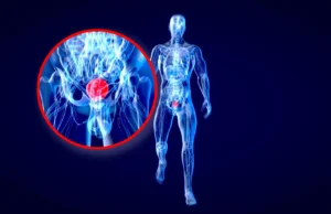 Cientistas de Stanford dizem que o daltonismo pode esconder sinais de alerta de um câncer de bexiga mortal