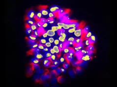 Nova ferramenta de IA prevê propagação do câncer com precisão surpreendente