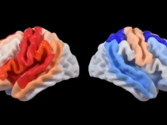 O AVC desencadeia uma mudança cerebral oculta que se parece com regeneração