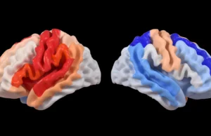 O AVC desencadeia uma mudança cerebral oculta que se parece com regeneração