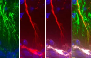 Cientistas descobrem células cerebrais ocultas que podem impedir o acúmulo de tau no Alzheimer