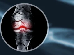 Cientistas criam estruturas de cartilagem que ajudam o corpo a regenerar os ossos