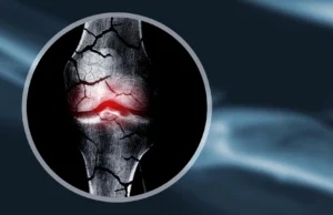 Cientistas criam estruturas de cartilagem que ajudam o corpo a regenerar os ossos