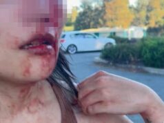 Canberra fica à margem após ser espancada aleatoriamente e ameaçada com uma faca por outra mulher em um ataque racista