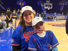 Menino incrivelmente corajoso, de 10 anos, visto pela primeira vez depois que acidente de jato médico deixou 90% de seu corpo queimado