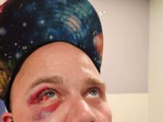 O desavergonhado ladrão de lojas de Portland SUES o balconista que o espancou depois de fugir do supermercado com o carrinho cheio de bifes