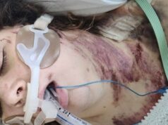 Mulher autista, 24 anos, trabalhou duro para construir uma vida independente para si mesma… agora paralisada pelo egoísmo de um estranho