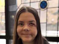 A ocupada mãe do Alasca compartilha seu terrível ferimento um ano depois de ter sido atacada por um urso enquanto saía para uma corrida matinal