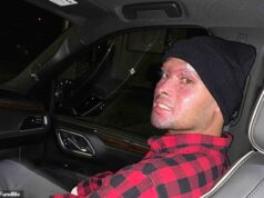 Um homem desavergonhado de 28 anos de Portland entrou com uma ação de US$ 17,5 milhões contra a polícia depois de ficar tão chapado com cogumelos mágicos e maconha que queimou todos os dedos, exceto dois.