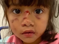 Imigrante ilegal ‘canibal’ deixado para vagar livremente por Biden após ataque violento, outro ataque selvagem e rosto de criança mordido