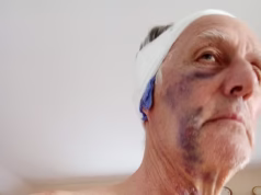 O magistrado aposentado Carpenter bate na cabeça de um vizinho com madeira 3×4 depois de reclamar de barulhentas obras de reforma em um vilarejo pitoresco