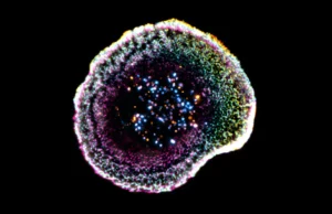 Primeira visualização em 3D mostra como as células T assassinas destroem o câncer