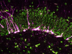 Este gás cerebral do “ovo podre” pode ser a chave para combater a doença de Alzheimer