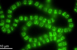 Cientistas ficaram chocados quando bactérias reciclaram máquinas de DNA para moldar células