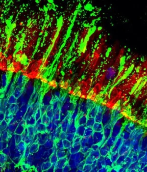 human-retinal-organoid.webp.webp