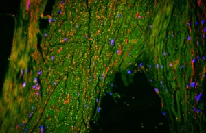 Cientistas acabam de encontrar um “dreno” escondido dentro do cérebro humano