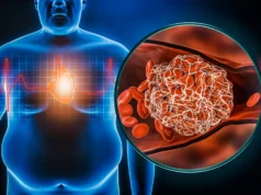 Homens e mulheres com obesidade enfrentam riscos de saúde ocultos muito diferentes