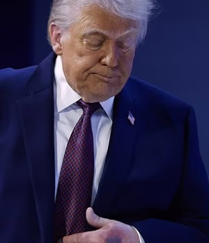 108886523-15850395-President_Donald_Trump_has_been_subject_to_bruising_which_doctor-a-25_17799088964.avif