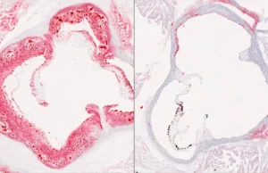 Cientistas descobrem interruptor hepático oculto que reduz o colesterol prejudicial