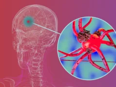 Pesquisadores bloqueiam proteínas-chave que ajudam o Parkinson a se espalhar pelo cérebro