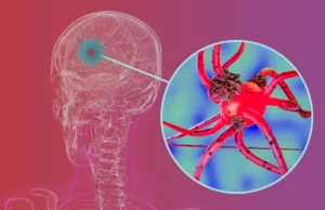 Pesquisadores bloqueiam proteínas-chave que ajudam o Parkinson a se espalhar pelo cérebro
