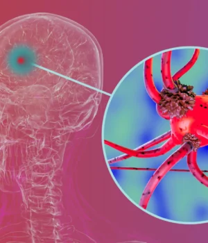 human-brain-cells-affected-by-parkinsons-disease.webp