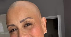 Desde penteados TikTok até não comer carne suficiente, os especialistas revelaram o que pode desencadear a alopecia, já que Melanie Sykes revelou que agora está ‘dois terços’ careca.