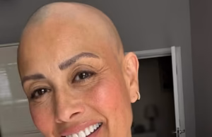 Desde penteados TikTok até não comer carne suficiente, os especialistas revelaram o que pode desencadear a alopecia, já que Melanie Sykes revelou que agora está ‘dois terços’ careca.