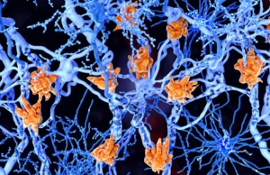 Estas células cerebrais cheias de gordura podem piorar a esclerose múltipla