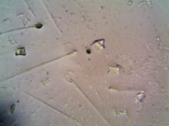 A vida complexa pode ter começado antes que a Terra tivesse muito oxigênio. Uma investigação sobre a natureza liderada pela Universidade de Bristol descobriu que a antiga linhagem arcaica por detrás de todas as plantas, animais e fungos começou a construir maquinaria celular complexa em oceanos anóxicos há cerca de 2,9 mil milhões de anos – cerca de mil milhões de anos antes do que alguns cientistas pensavam.