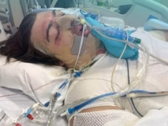 Homem australiano em estado crítico depois que o aspirador de robô explode em um acidente estranho