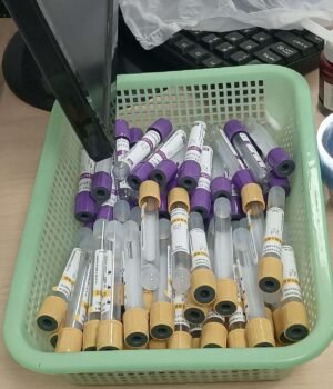 1280px-Blood_collection_renal_function_test_tube.jpg