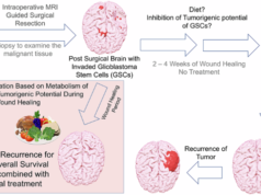 Dieta com baixo teor de carboidratos e alto teor de gordura reduz o glioblastoma, alterando lipídios e limitando a flexibilidade metabólica das células-tronco do câncer