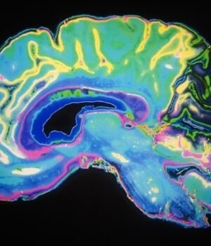 Artificially_Colored_MRI_Scan_Of_Human_Brain-Daisy_Daisy_a8c5d8bbbf824bc8932308e30187510f-620x480.jp_.jpeg