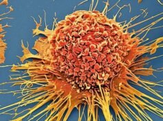 Tecnologia sem quimioterapia mata 99% das células cancerígenas em laboratório: Alerta científico
