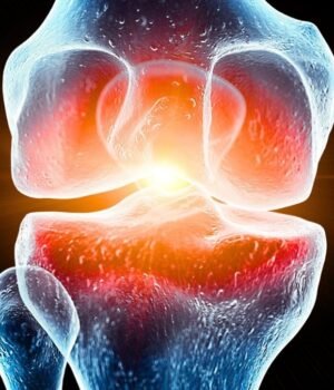 Illustration-of-a-painful-knee-joint-by-Science-Photo-Library-.jpg