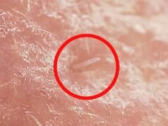 Os ácaros vivem na sua boca e, em uma reviravolta terrível, eles estão começando a se misturar com os humanos: Alerta Científico