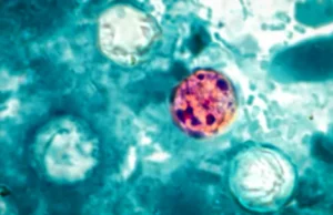 CDC adoece mais de 400 em busca da fonte do surto misterioso
