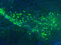 Cientistas de Yale podem ter descoberto como a doença de Parkinson se espalha pelo cérebro