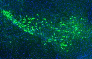 Cientistas de Yale podem ter descoberto como a doença de Parkinson se espalha pelo cérebro