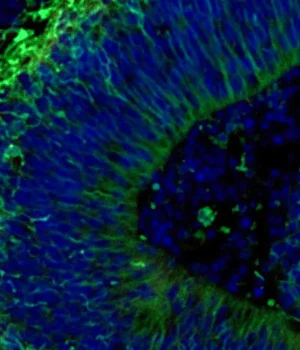 fluorescent-image-of-brain-organoid.webp