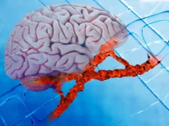 Novo medicamento para Alzheimer repara danos no DNA e reduz inflamação cerebral