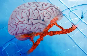 Novo medicamento para Alzheimer repara danos no DNA e reduz inflamação cerebral