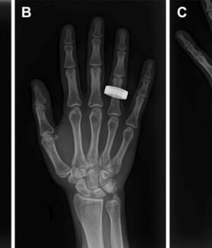 hand-x-rays.jpg