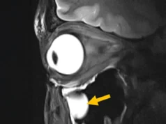 Nova descoberta de ressonância magnética revela cérebro e olhos como nunca antes